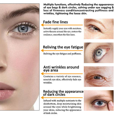 ARTISCARE Crema Antiedad para Contorno de Ojos - Image 4