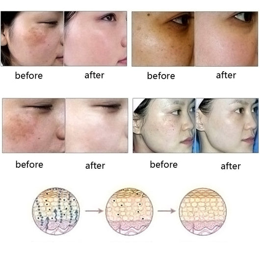 Esencia Facial Meridian - Tratamiento Natural para Acné, Estrías y Cicatrices - Image 3