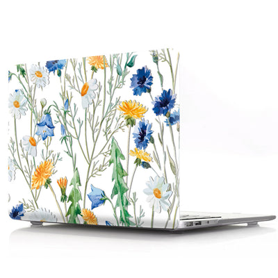 Funda Protectora Transparente para MacBook y Apple con Diseño Personalizado - Image 5