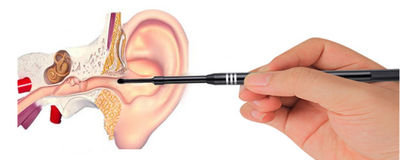 Otoscopio Endoscópico con Pinza de Extracción - Image 9
