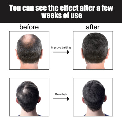 Esencia Capilar Densificante para Hombre - Nutrición Intensiva - Image 12