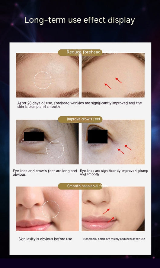 Dispositivo de Lifting Facial con Microcorriente y Patrón de Luz - Image 19