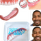 Carillas Dentales Correctivas para una Sonrisa Perfecta