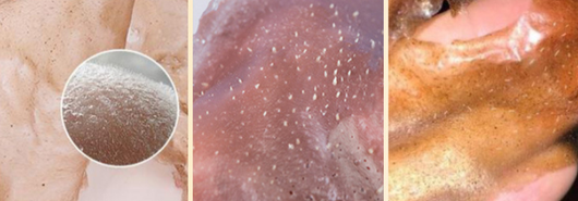 Mascarilla Limpiadora Profunda Antiespinillas - Image 11