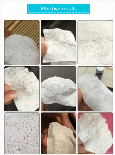 Mascarilla Nasal Limpiadora de Puntos Negros - 60 Láminas Potentes para Zona T - Image 3