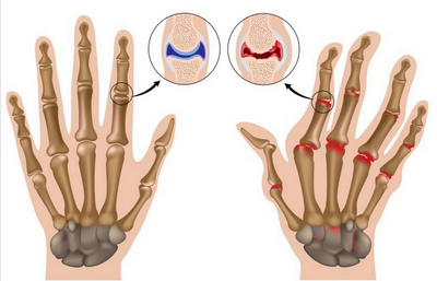 Guantes de Recuperación Deportiva con Fibra de Cobre - Image 3