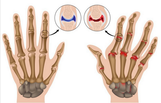 Guantes de Recuperación Deportiva con Fibra de Cobre - Image 3