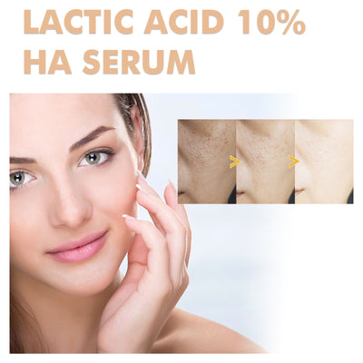 Esencia Facial de Ácido Láctico Anti-acné, Antiarrugas e Hidratante - Image 3