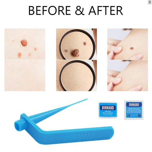 Herramientas Profesionales de Cuidado Facial - Image 3