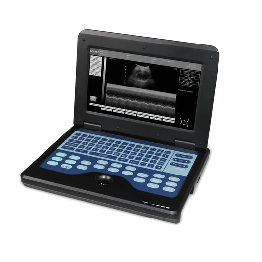 Ecógrafo Portátil Digital con Sonda Convexa 3.5 - Diagnóstico Profesional - Image 6