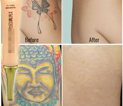 Crema Eliminadora de Tatuajes - Image 3