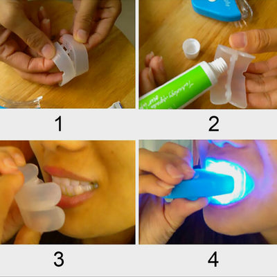 Kit de Blanqueamiento Dental con Gel y Luz LED - Image 10