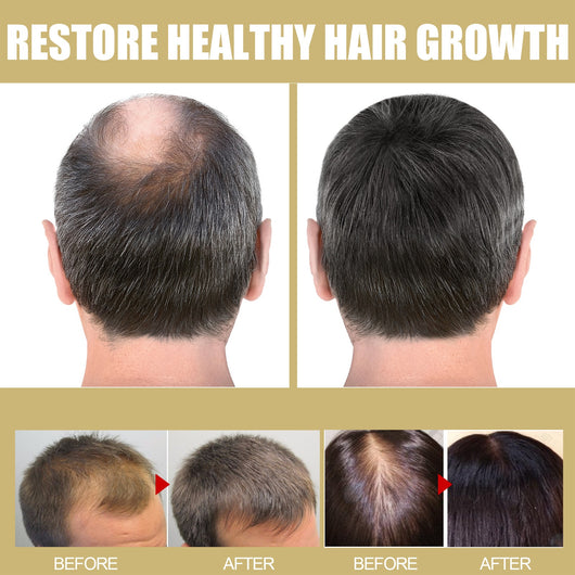Gorro Térmico Reparador para Cabello Dañado y Reseco con Masaje - Image 21