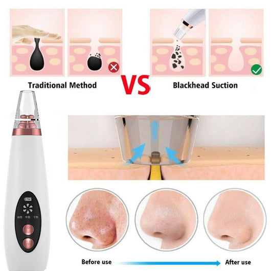 Extractor de Poros Facial - Dispositivo Limpiador de Puntos Negros - Image 23