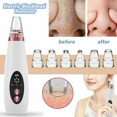 Extractor de Poros Facial - Dispositivo Limpiador de Puntos Negros - Image 25