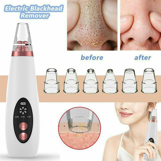 Extractor de Poros Facial - Dispositivo Limpiador de Puntos Negros - Image 25