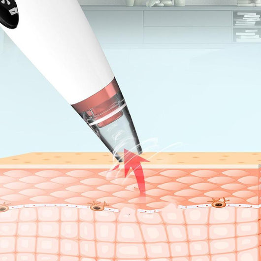 Extractor de Poros Facial - Dispositivo Limpiador de Puntos Negros - Image 26
