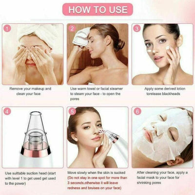 Extractor de Poros Facial - Dispositivo Limpiador de Puntos Negros - Image 27