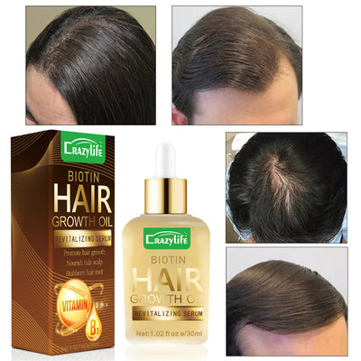 Aceite Esencial para Cabello 30ml - Suavidad y Frescura Instantánea - Image 6