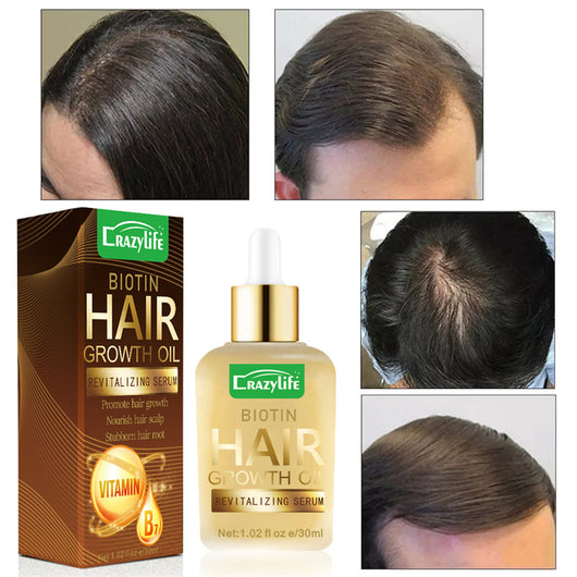 Aceite Esencial para Cabello 30ml - Suavidad y Frescura Instantánea - Image 6