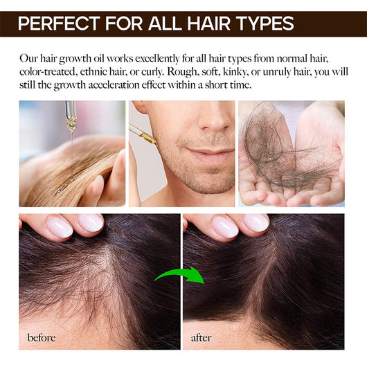 Aceite Esencial para Cabello 30ml - Suavidad y Frescura Instantánea - Image 20