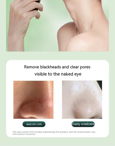 Limpiador Ultrasónico Facial con Masaje Lifting y Tonificación - Image 24