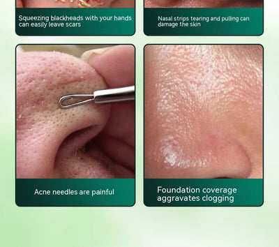 Limpiador Ultrasónico Facial con Masaje Lifting y Tonificación - Image 28