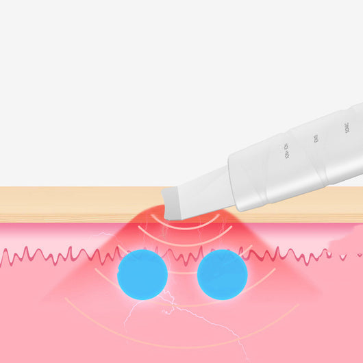 Limpiador Facial Ultrasónico Extractor de Puntos Negros - Image 7