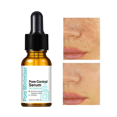 Sérum Reductor de Poros 10ml - Image 8
