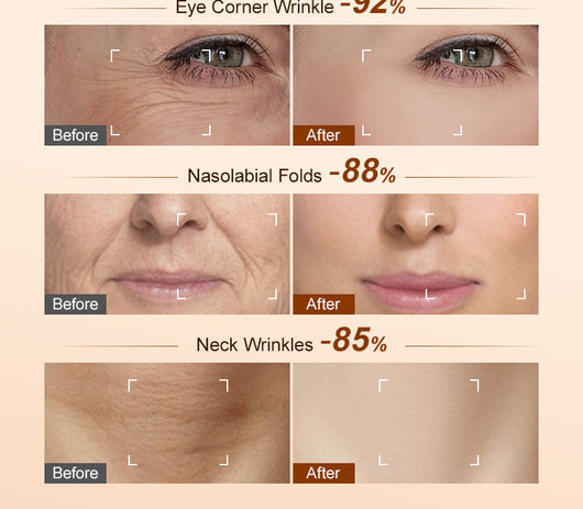 Crema Facial Hidratante Iluminadora - Reduce Opacidad y Devuelve el Brillo - Image 17