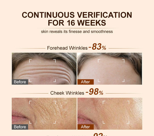 Crema Facial Hidratante Iluminadora - Reduce Opacidad y Devuelve el Brillo - Image 22