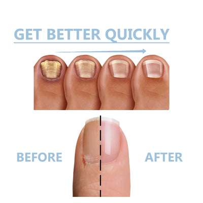 Tratamiento Nutritivo para Uñas de Manos y Pies - Reparación Intensiva y Brillo Natural - Image 24
