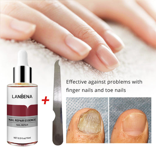 Tratamiento Reparador de Uñas 15ml Anti-Hongos para Pies - Image 11