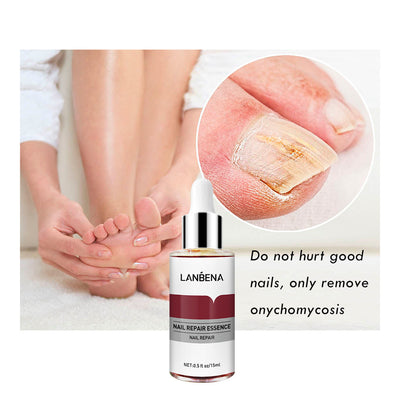 Tratamiento Reparador de Uñas 15ml Anti-Hongos para Pies - Image 12