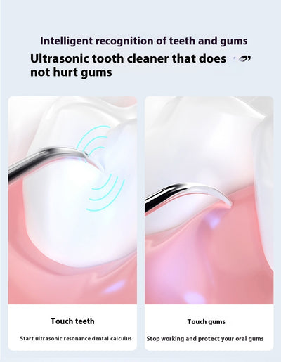 Removedor Ultrasónico de Sarro y Manchas Dentales Profesional - Image 16