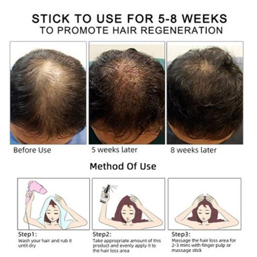 Aceite Esencial para Crecimiento del Cabello - Image 14