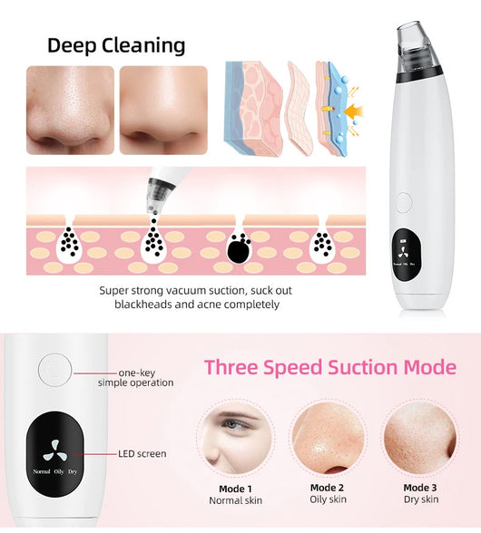 White blackhead vacuum remover with rose gold accents, clear suction head, and control buttons for strong, normal, and soothe modes. - Image 27