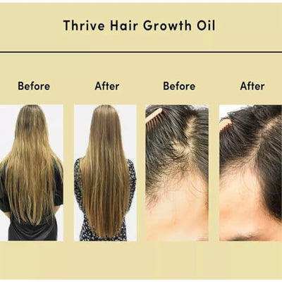 Aceite Esencial Reparador para Cabello Delicado y Suave - Image 21