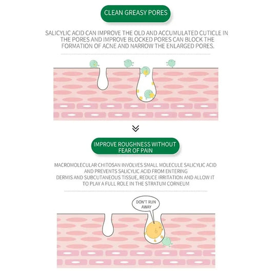 Sérum Salicílico Reductor de Poros - Elimina Puntos Negros y Repara Marcas de Acné - Image 36