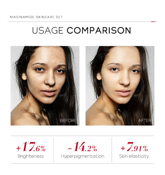 Set de 4 Productos Nicotinamida para Hidratación y Belleza - Image 22