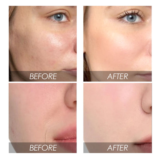 Crema Facial de Cúrcuma: Reductor de Manchas Oscuras y Antiarrugas - Image 15