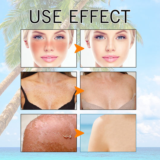 Gel Protector Hidratante con Ácido Hialurónico - Protección Solar y Frescura sin Grasa - Image 21