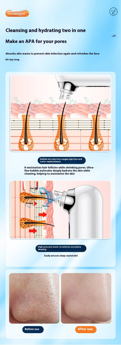 White and silver electric blackhead remover with clear water tank, purple suction head, and multiple probes. - Image 24