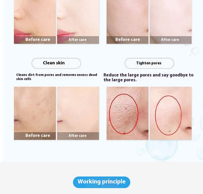 Dispositivo de Radiofrecuencia para Lifting Facial y Corporal - Image 8