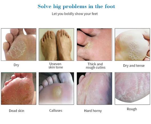 Calcetines Exfoliantes para Pedicura - Mascarilla Regeneradora para Pies - Image 8