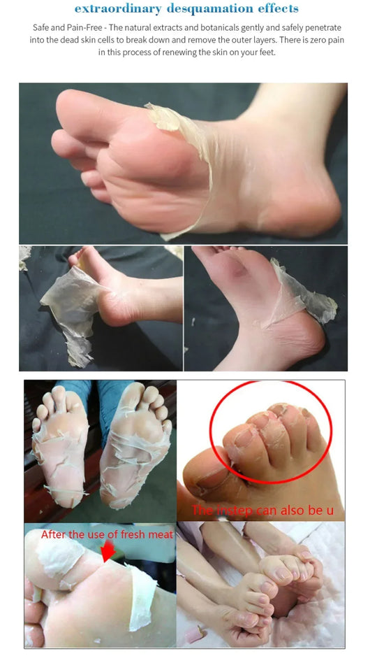 Calcetines Exfoliantes para Pedicura - Mascarilla Regeneradora para Pies - Image 10
