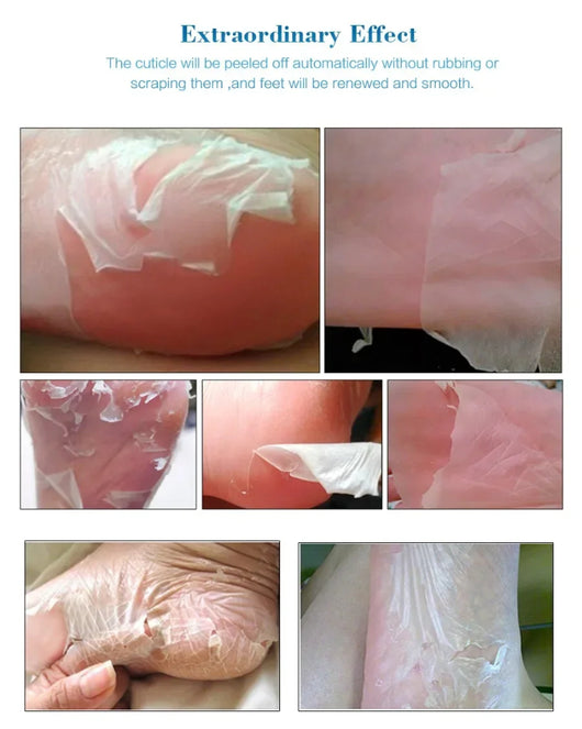 Calcetines Exfoliantes para Pedicura - Mascarilla Regeneradora para Pies - Image 14