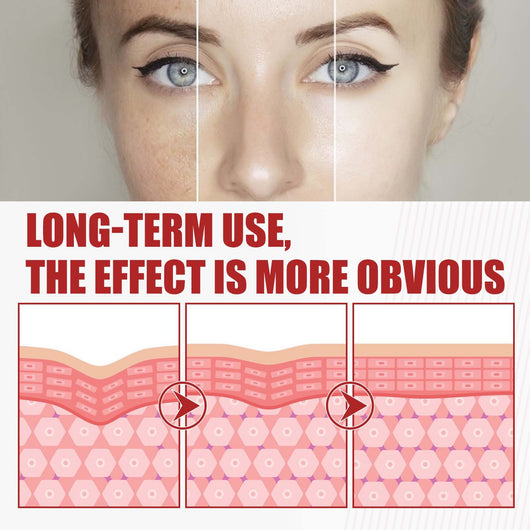 Sérum Reparador Antiedad con Tecnología Exosomal - Reduce Líneas de Expresión - Image 9