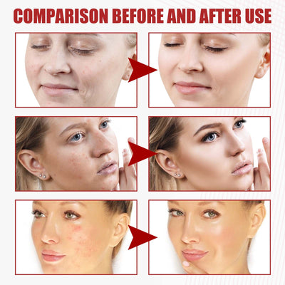 Sérum Reparador Antiedad con Tecnología Exosomal - Reduce Líneas de Expresión - Image 12