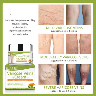 Crema Correctora de Estrías y Venas - Image 6